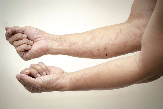 personal-injury-law-640x480-1943573.jpeg