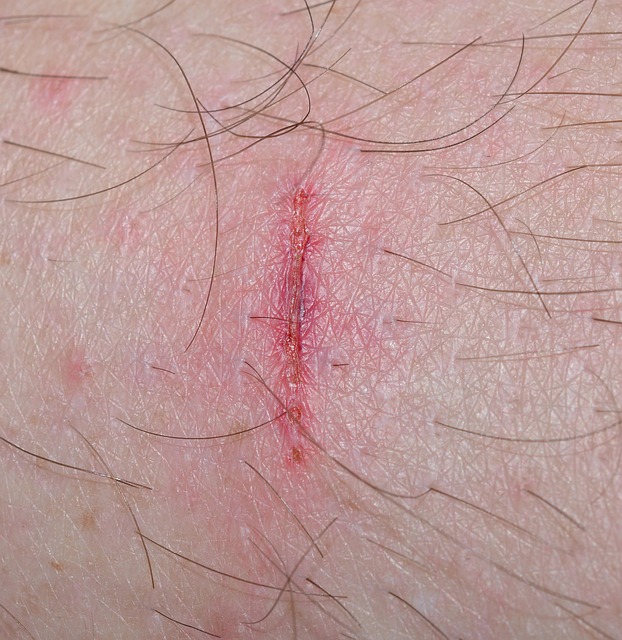 personal-injury-law-640x480-82420131.jpeg
